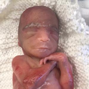 Robert-Lewis David Trapper